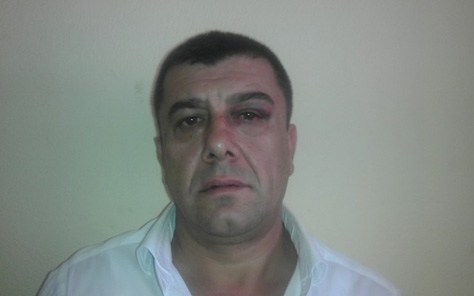 Interpoli nis procedurat për ekstradimin e Arben Frrokut