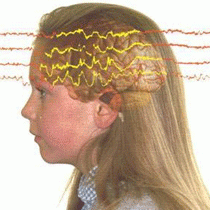 Fëmijët me epilepsi duhet të kurohen edhe për autizëm