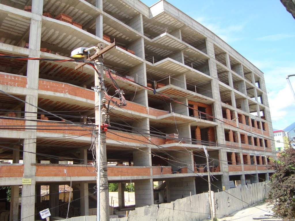 Rrëzohet nga pallati në Durrës, i ngulet hekuri në bark