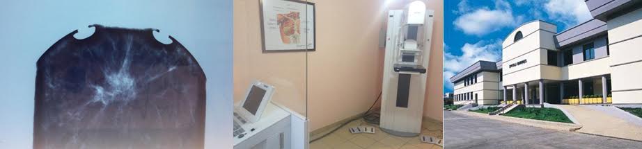 Durrës. Ende jashtë funksionit mamografia në spitalin publik