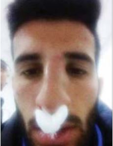 Futbollisti: Theva hundën, mjeku ishte tapë