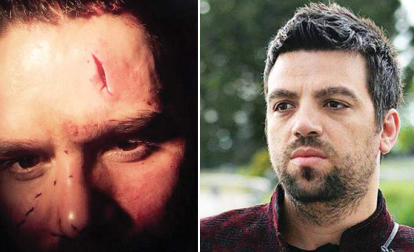 Stine: Nuk kam dhunuar askënd, jeta vazhdon