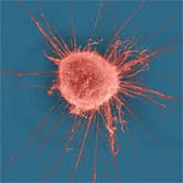 Terapia e qelizave T (Video)