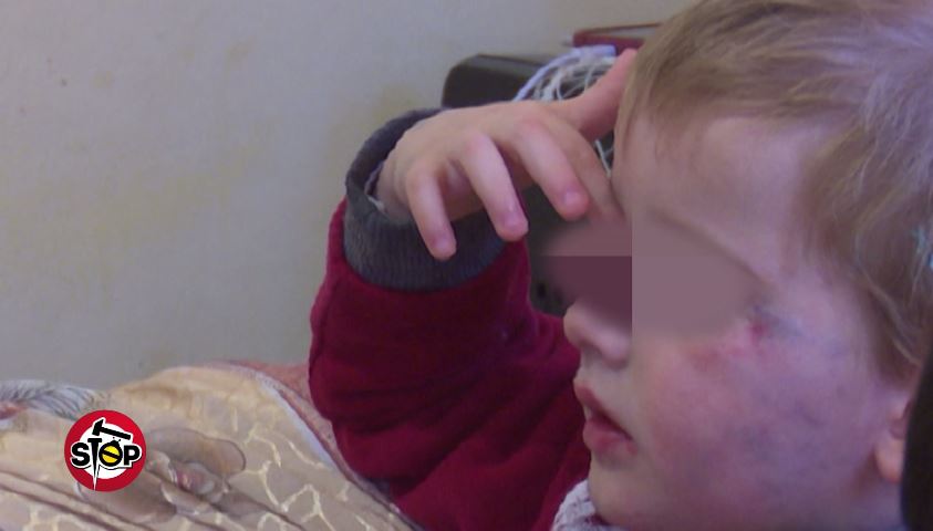 Skandal në Shtëpinë e Foshnjës në Durrës, kujdestarja dhunon fëmijën 3 – vjeçar (Video – Stop)