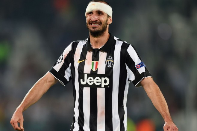Juventus, dëmtohet Giorgio Chiellini