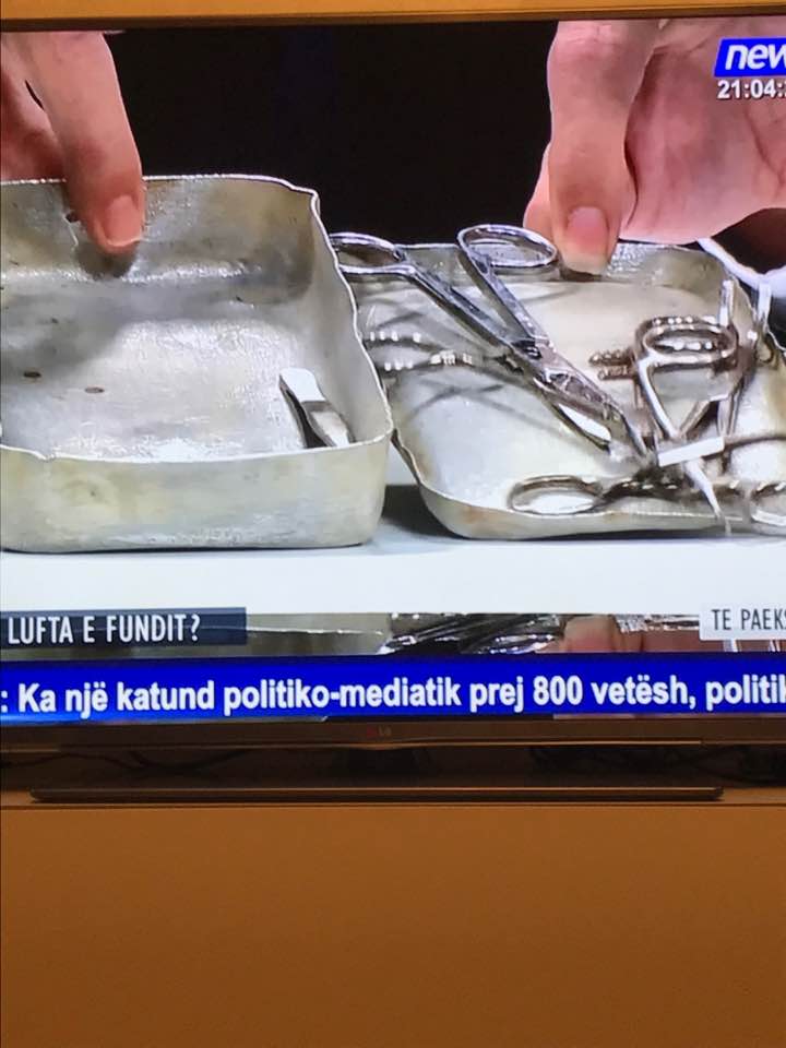 Për çfarë e ka lënë thoin kaq të gjatë Edi Rama?! (FOTO)