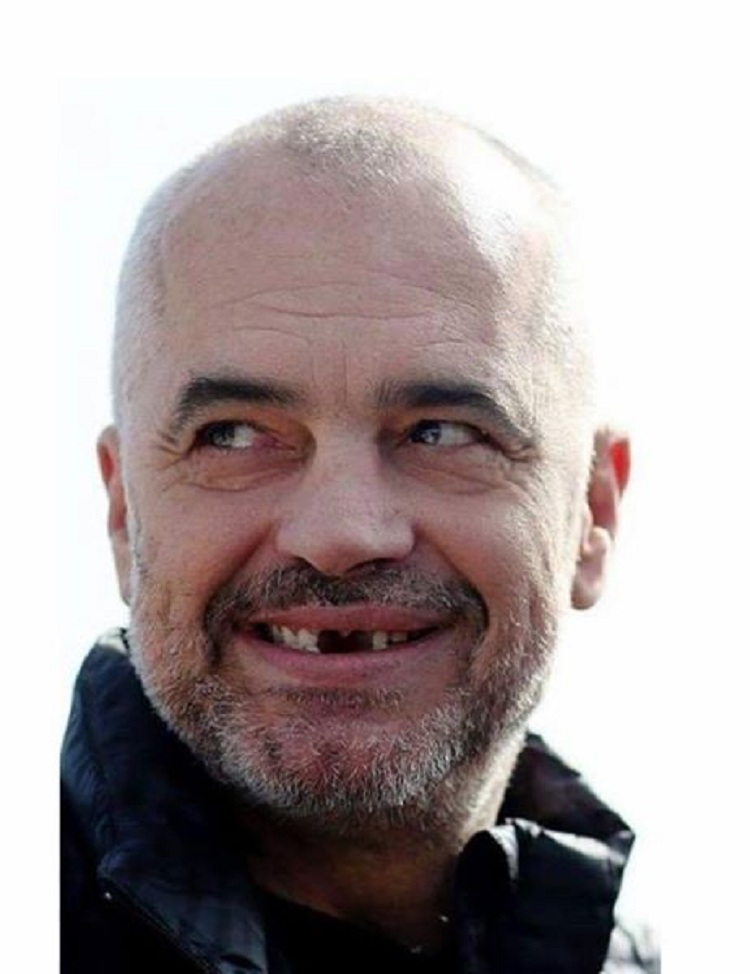 Reagon Berisha pas ftesës: Rama i shkruan Bashës me stil ordineri, si Mili