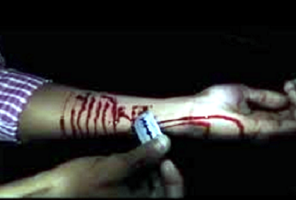 Tronditëse/ I vdiq vajza 19 vjeçe, babai pret damarët në varreza