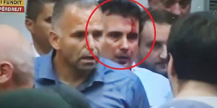 Situatë e jashtëzakonshme, 10-15 deputetë të lënduar (VIDEO)