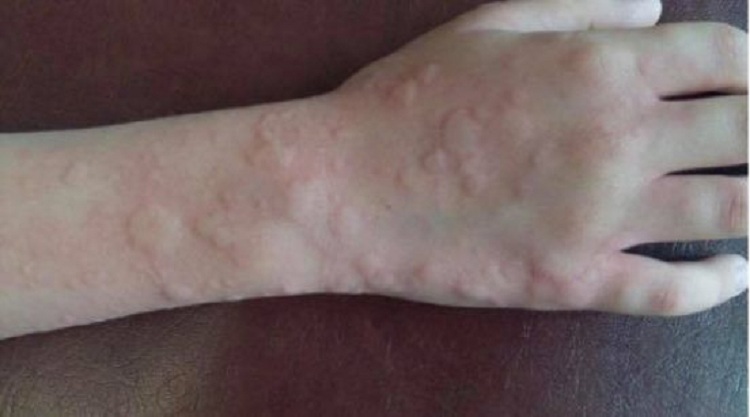 Berisha publikon fotot e qytetarëve të lënduar në mitingun e PD-së