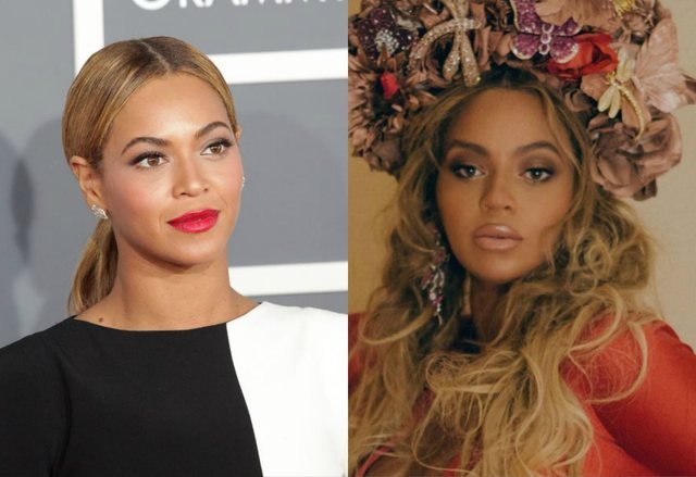 Shtatzënia apo kirurgjia? Çfarë ka ndodhur me buzët e Beyonce-s? (FOTO)