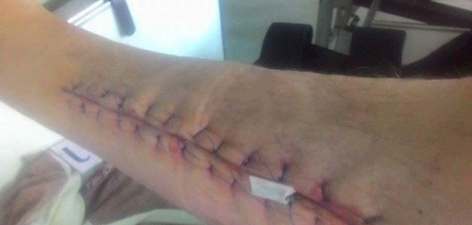 Rrëfimi i frikshëm: “Po më hante nga brenda” (FOTO)