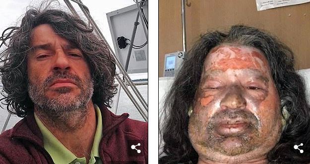 iPhone i shpëton jetën burrit pas shpërthimit në shtëpi