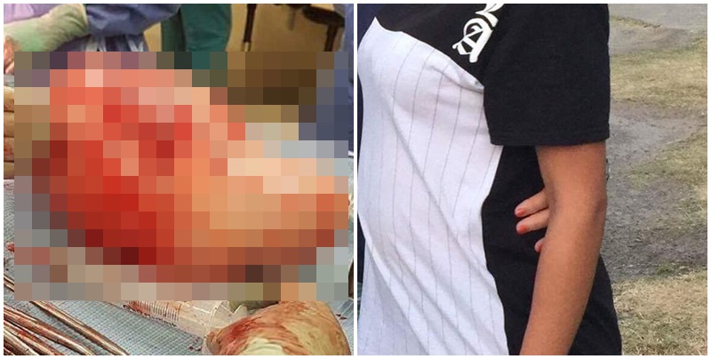 24-vjeçarja mbetet e shokuar nga ajo çka lindi në operacion