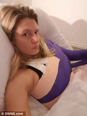 “Sëmundja e padukshme që po më shpërbën çdo ditë” (FOTO)