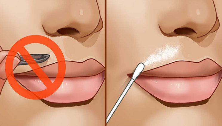 Si të eleminoni qimet mbi buzë pa shkuar tek estetistja/ Dy maska natyrale