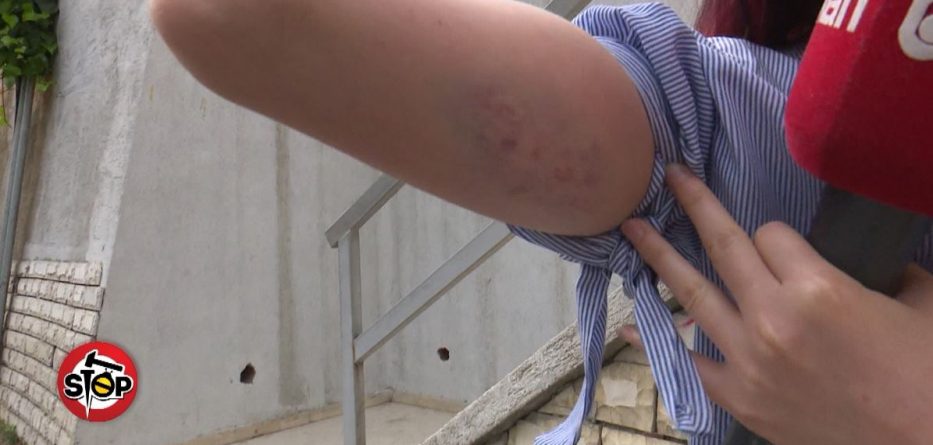 “T’i këpus të 2 duart”! Pezullohet polici që ushtroi dhunë ndaj gazetares (VIDEO)