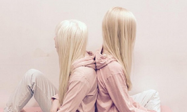 Bukuria e albinëve (FOTO)