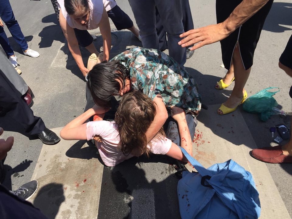 Pamje të rënda/ Motori me shpejtësi rrufe përplas nxënësen tek vijat e bardha