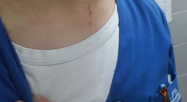 DETAJET/ Si u kërcënua me jetë infermieri në mes të urgjencës (FOTO)