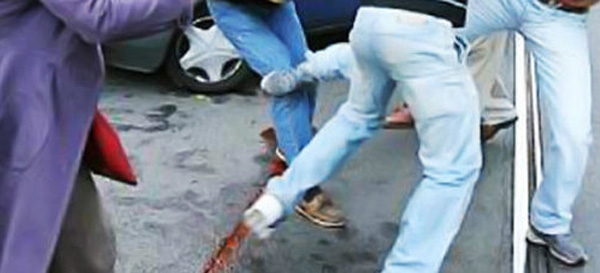 EMRAT/ Katër simpatizantë të PD-së rrahin militantin e LSI-së