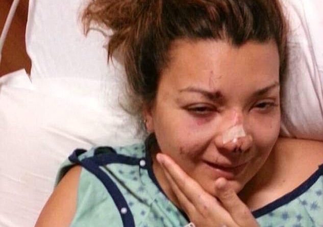 I mbijetoi mrekullisht goditjes nga rrufeja