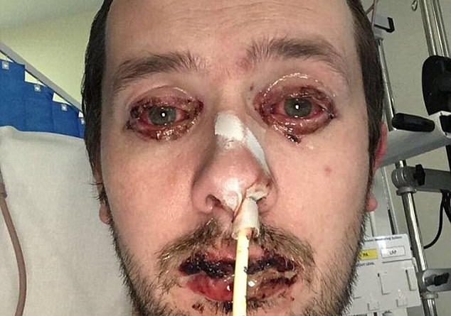 Mendonte se ishte me grip, por u shokua nga ajo që pa (FOTO)