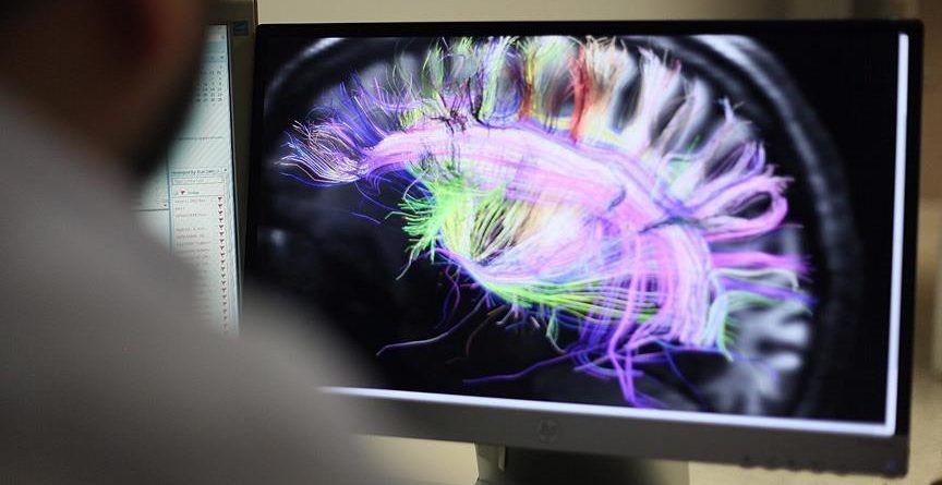 Truri i psikopatëve punon më ndryshe