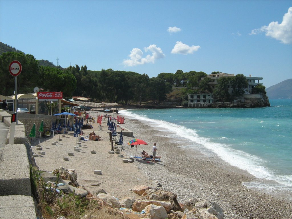 Dëmtime në dorë e brinjë, 38-vjeçarin që kishte dalë për vrap e bëjnë për spital