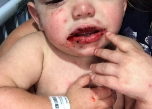 E puthi shoku i babait, foshnja rrezikoi të humbiste jetën