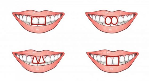 Çfarë tregon forma e dhëmbëve të parë për karakterin tuaj