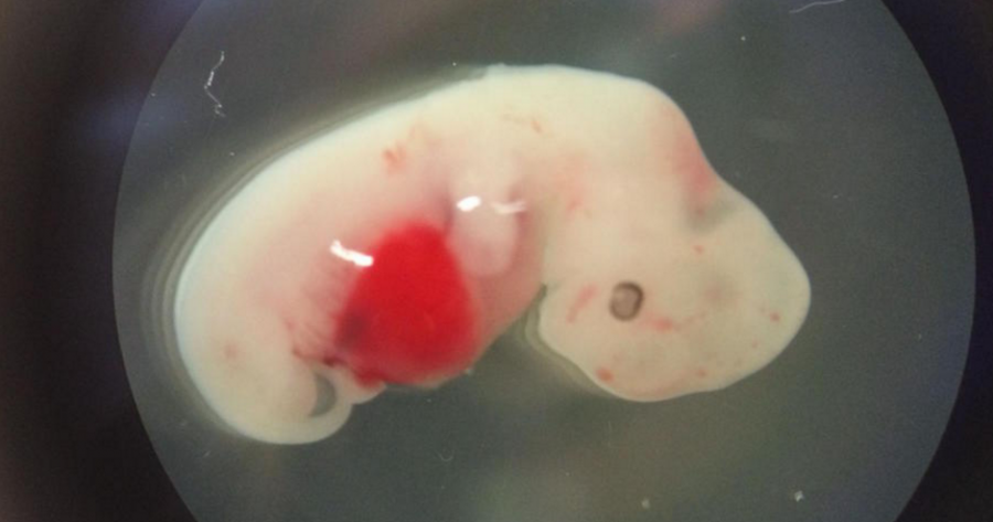 Shkencëtarët krijojnë hibridin njeri-derr, mund të zgjidhë transplantin e organeve