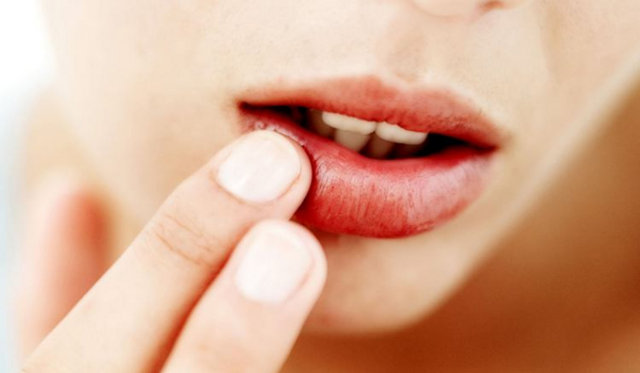 Çfarë tregon ngjyra e buzëve për shëndetin tuaj