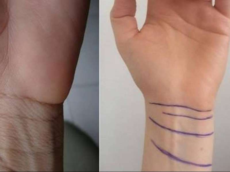 Vijat në kyçin tënd janë 3 apo 4? Domethënia që fshihet pas tyre