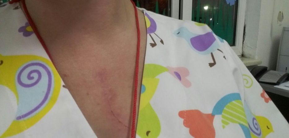 22-vjeçarja godet me grushte infermieren se nuk i mbante fëmijën