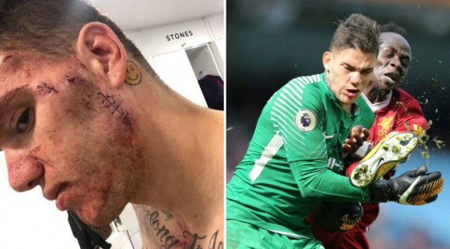 Ederson dëmtim horror, Mane dënohet me 3 ndeshje