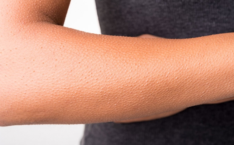 Ja pse ju rrënqethet mishi kur dëgjoni muzikë