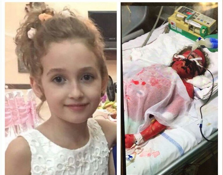 Apeli për ndihmë për Kejsin, miliona lekë mblidhen për kurimin e vogëlushes që lufton me vdekjen