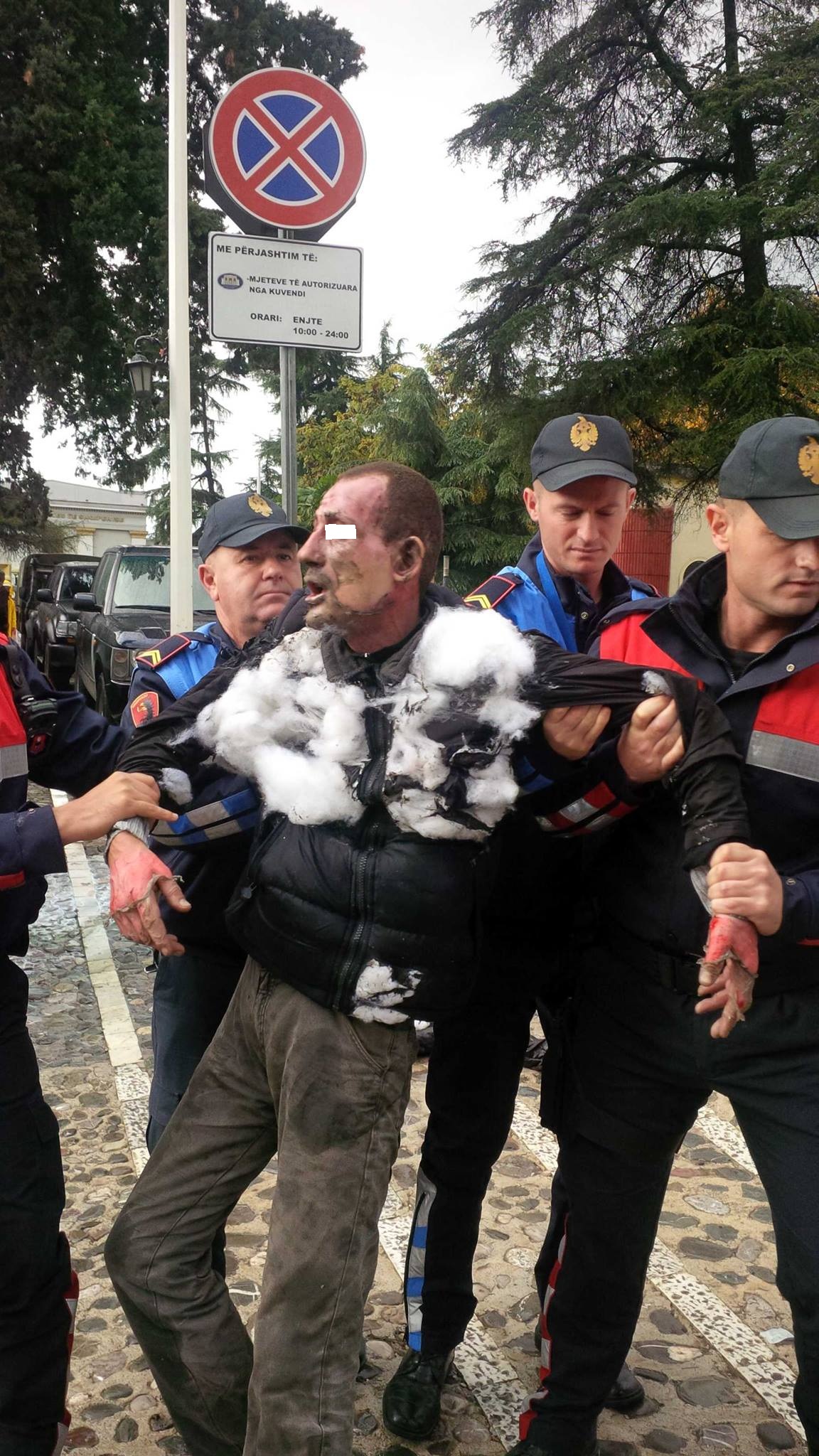 35-vjeçari i vë flakën vetes para Parlamentit, e shpëton policia