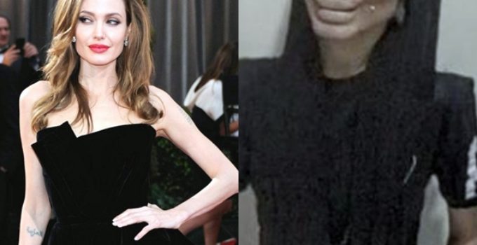Operacione plastike për t’i ngjarë Angelina Jolie-s, shndërrohet e frikshme (FOTO)