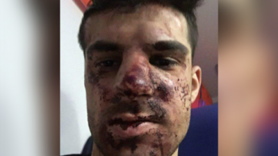 Sherr për një vend parkimi, masakrohet futbollisti