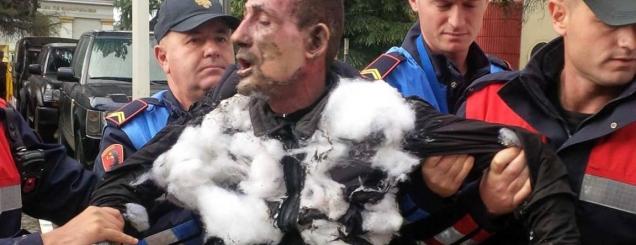 I vuri flakën vetes, vëllai i 35-vjeçarit tregon arsyen: Njerëzit e ish-gruas nuk e…