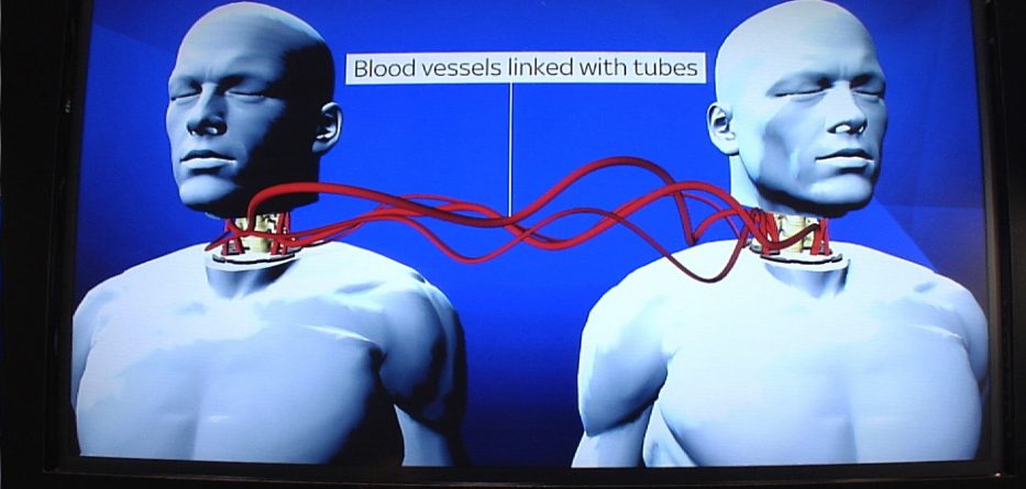 Kryhet transplanti i parë i kokës