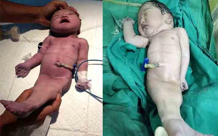 Lind fëmija ‘sirenë’