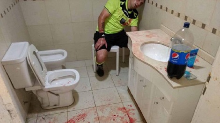 Horror në Argjentinë, arbitri i mbuluar me gjak për shkak të… (VIDEO)
