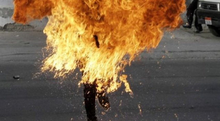 Gruaja i vë flakën vetes, burri tenton ta ndihmojë po digjet vetë