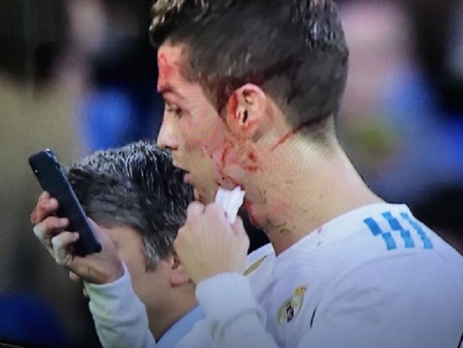 Gjakoset gjatë shënimit të golit, shikoni si reagon Ronaldo (VIDEO)