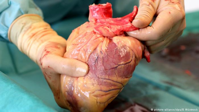 Çështje jete a vdekjeje – Dhurimi i organeve