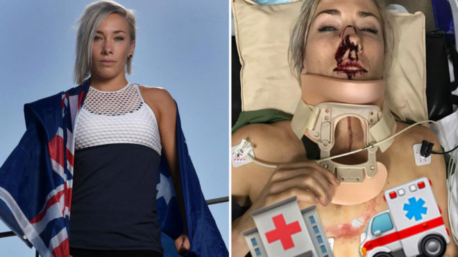 Kampionia seksi e biçikletës aksident rrugor, poston pamje tronditëse