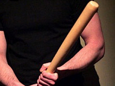 Dhunohet me shkop bejsbolli shefi i burgut 313